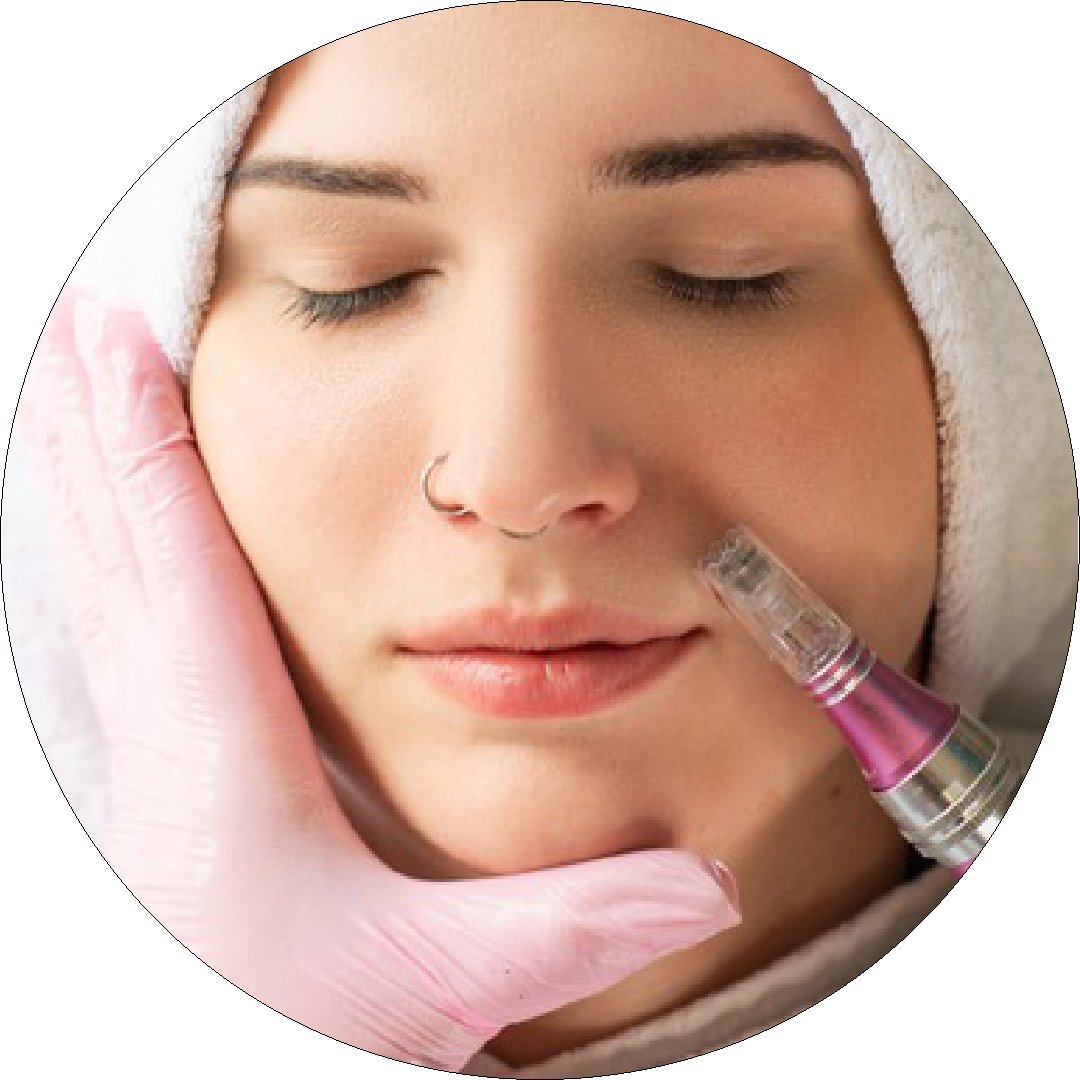1.2-beautify-kosmetik-microneedeling