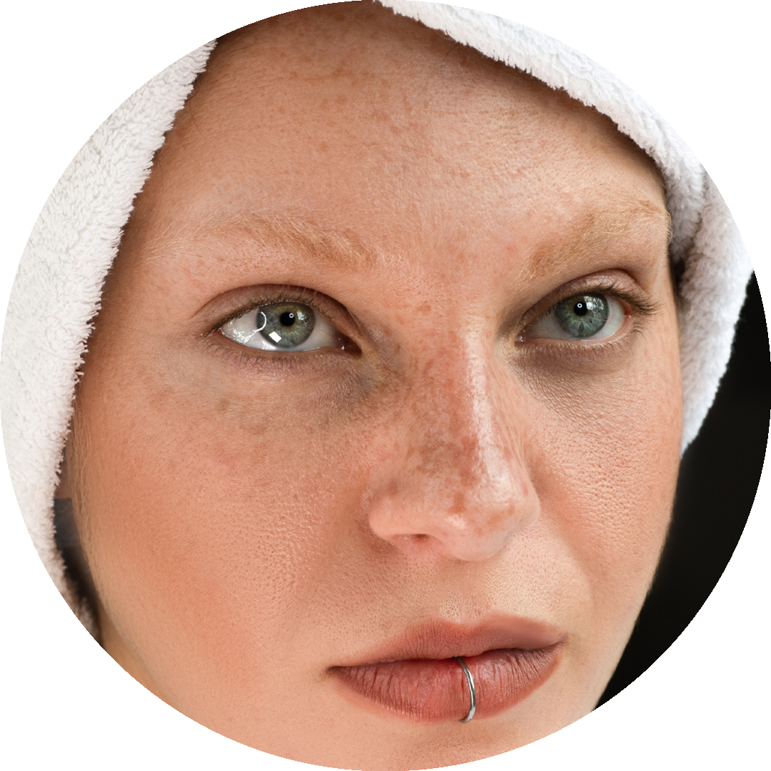 3.7-beautify-permanentmakeup-sommersprossen2